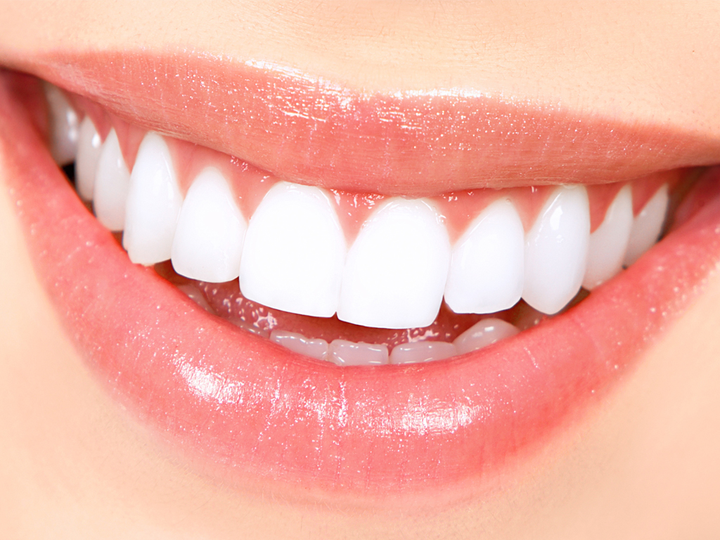 Teeth whitening tips